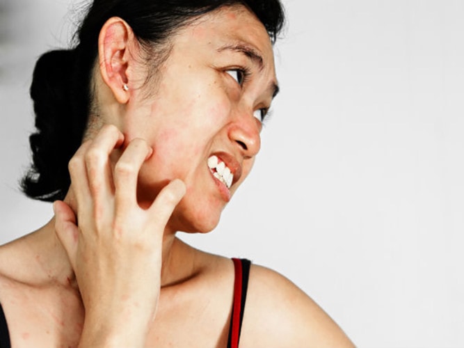 bệnh gan nhiễm mỡ, gan nhiễm mỡ, dấu hiệu gan nhiễm mỡ