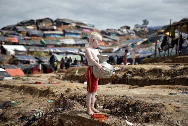 Một người t ref nạn Rohingya thuộc chủng tộc albino đặt ra cho một bức tranh ở Cox's Bazar, Bangladesh.