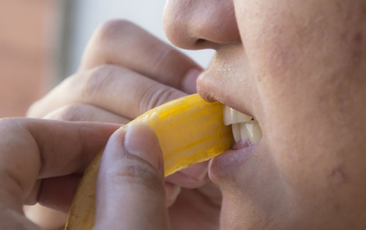 Vỏ chuối làm trắng răng: Vỏ chuối có chứa các chất làm tan mảng bám trên răng và giúp duy trì màu sắc hoàn hảo của răng. Chà mặt trong của vỏ chuối vào răng từ cả hai bên và chờ 5-7 phút. Sau đó đánh răng và rửa miệng. Lặp lại thường xuyên để có hiệu quả tốt nhất. Ảnh: wikihow