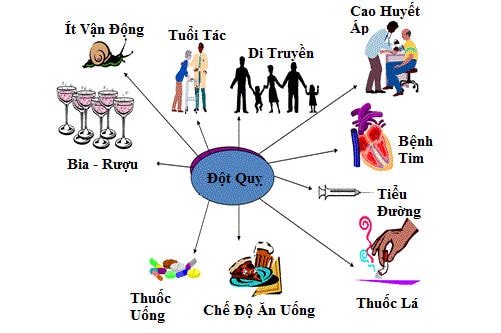 đột quỵ,tai biến mạch máu não