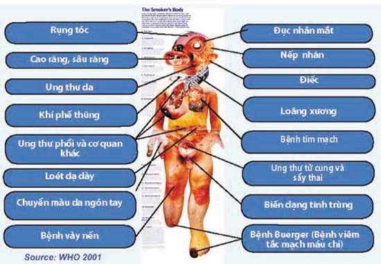 Áp phích của WTO về các bệnh do hút thuốc. Ảnh: TL