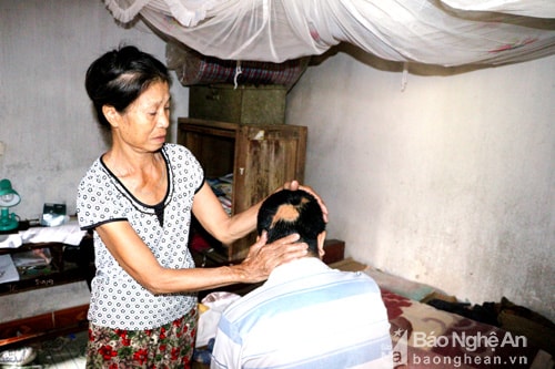 Mảnh xương sọ đang được nuôi trong bụng, đã quá lịch mổ lắp ghép hộp sọ nhưng vẫn chưa có tiền đành để chịu đau đớn