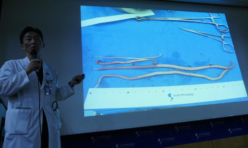 Bác sĩ Lee Cook-Jong thông báo về tình hình nhiễm giun sán ký sinh của binh sĩ Triều Tiên đào tẩu. Ảnh: CNN.