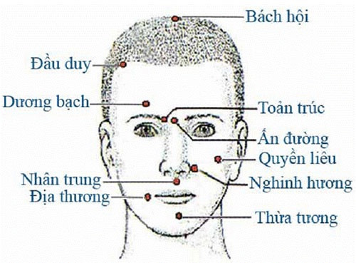 Một số huyệt vị cần tác động trong điều trị liệt mặt, méo miệng.