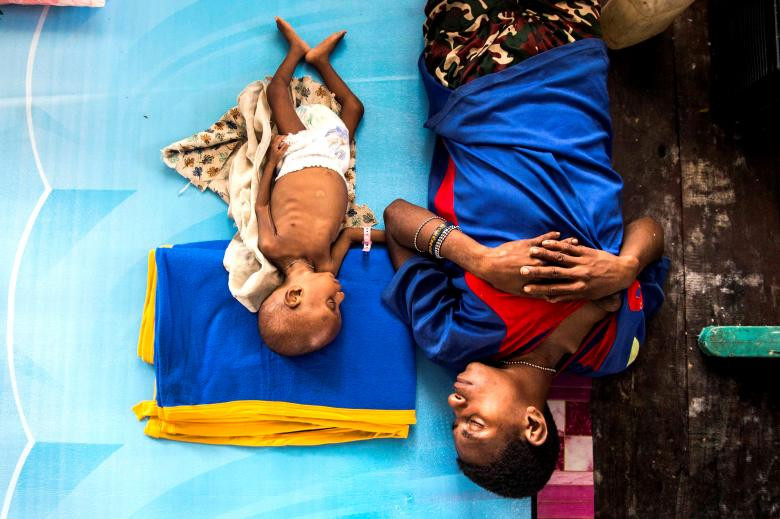 Một bà mẹ và đứa trẻ ba tuổi ngủ bên trong một nhà thờ Hồi giáo ở Agats, quận Asmat, sau khi chính phủ cử những quân nhân và nhân viên y tế đến vùng xa xôi của Papua để chống lại nạn suy dinh dưỡng và sởi Indonesia, ngày 22 tháng 1 năm 2018. 