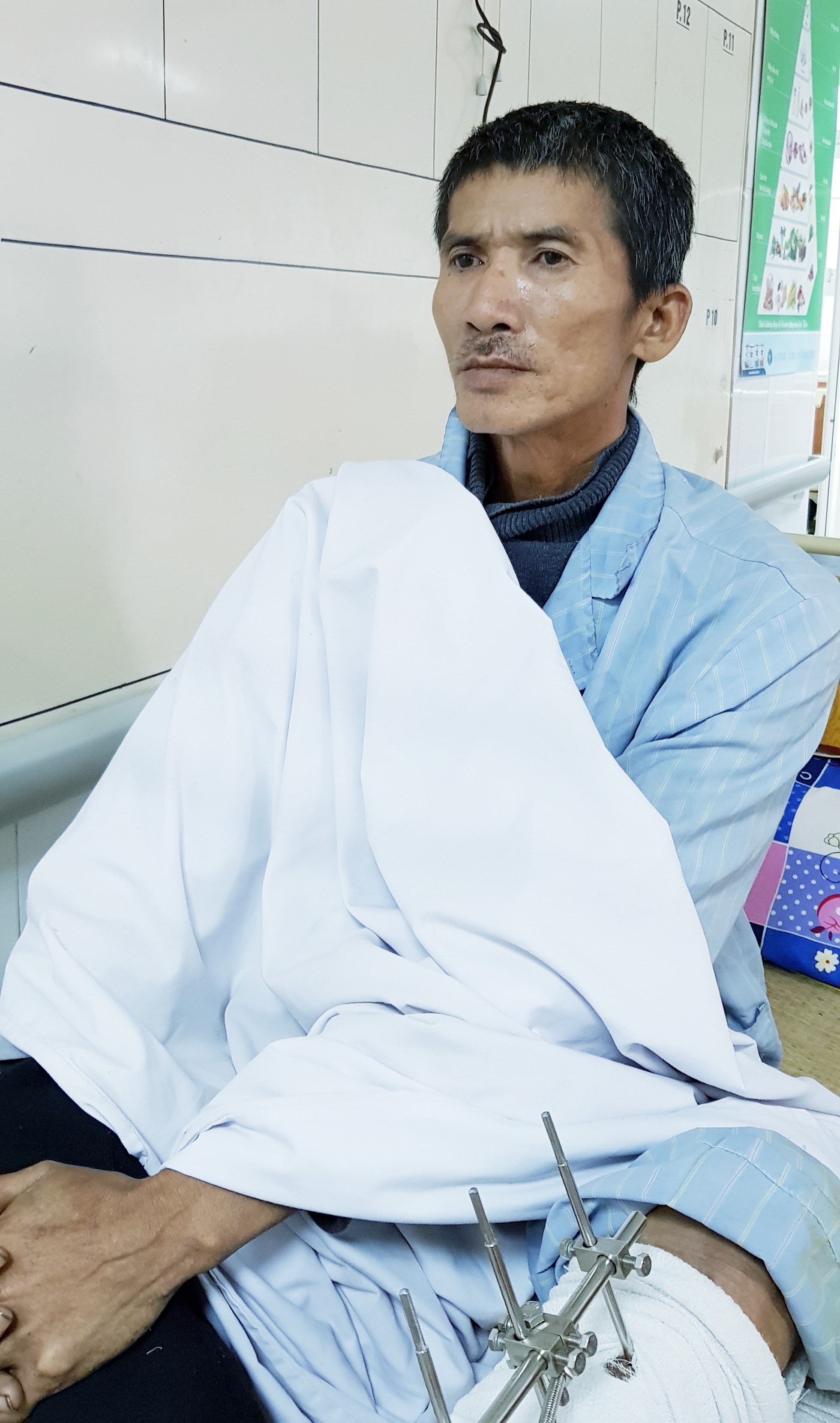 Nạn nhân đã tỉnh nhưng không thể cung cấp thông tin cá nhân. Ảnh:  Hoàng Yến