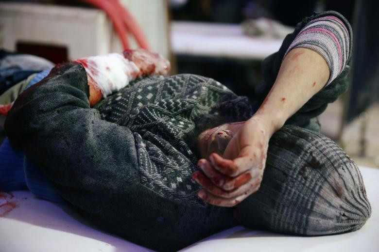 Một người đàn ông bị thương được nhìn thấy tại một điểm y tế ở thị trấn bị bao vây Douma, Eastern Ghouta, Damascus, ngày 20 tháng Hai