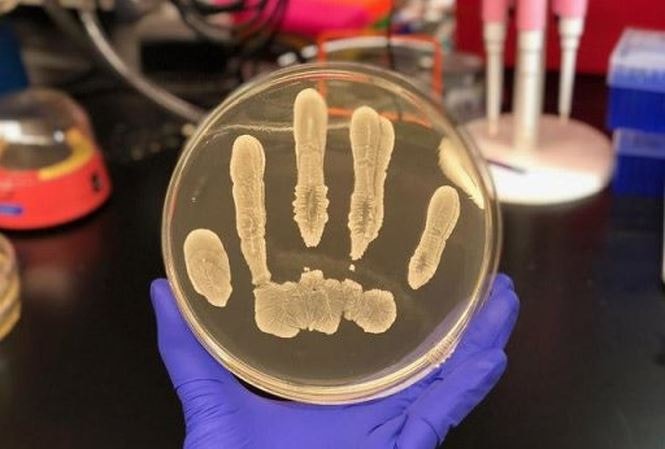 Khuẩn S. epidermidis đang phát triển trên một đĩa thạch (