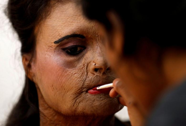 Một người sống sót sau cuộc tấn công bằng axit đã trang điểm cho cô ấy trước hậu trường của một chương trình thời trang để đánh dấu Ngày Phụ nữ Quốc tế ở Thane ở ngoại ô Mumbai, Ấn Độ vào ngày 7 tháng 3 năm 2018
