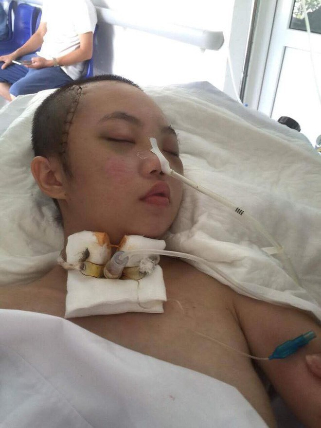 Vụ tai nạn khiến Linh bị chấn thương sọ não, nguy kịch đến tính mạng. Ảnh: Internet