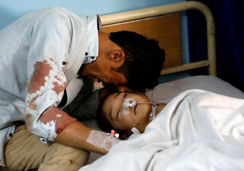 Một người đàn ông gục khóc bên bé gái bị thương tại một bệnh viên sau vụ tấn công liều chết ở Kabul, Afghanistan hôm 22/4.