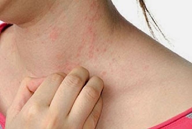 Nhiều loại hóa chất độc hại làm tăng nguy cơ ung thư ở con người có trong các sản phẩm vải vóc được Quỹ Quốc tế Bảo vệ thiên nhiên (WWF) cảnh báo. Ảnh minh họa: Internet