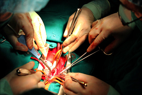 Phẫu thuật tim hở cho bệnh nhi tại Nghệ An. Ảnh: Thành Chung