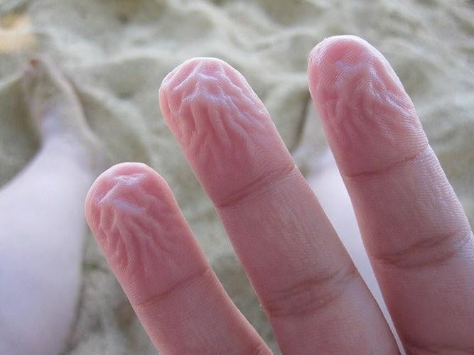 Phần da ở ngón tay, ngón chân nhăn nheo có thể là cảnh báo vấn đề sức khỏe. Ảnh minh họa: Internet