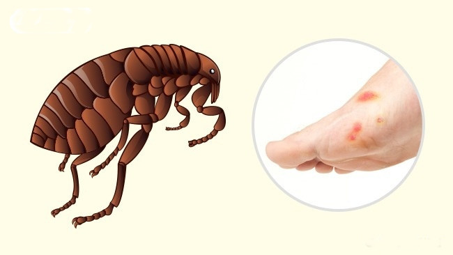 Vết bọ chét đốt dễ bị nhầm với muỗi đốt vì vết cắn cũng có màu đỏ, sưng. Tuy nhiên, vết bọ chét đốt đau, ngứa hơn vết muỗi đốt rất nhiều. Bọ chét thường cắn vào chân và chỉ cắn người ngủ; khoảng cách giữa các vết cắn từ 1 - 2 cm. Bọ chét là trung gian truyền nhiều bệnh nhiễm trùng nghiêm trọng.