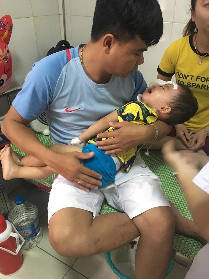Sau mổ, bé H đang được theo dõi và điều trị tại khoa Răng Hàm Mặt - Mắt của bệnh viện. Ảnh: Trần Hiền