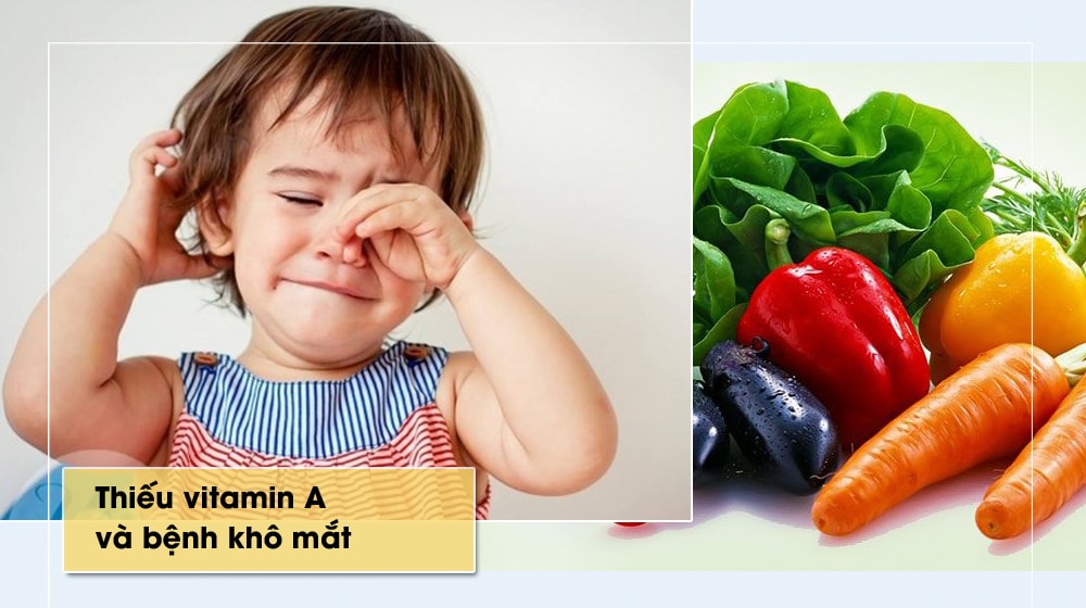 Vitamin A có vai trò quan trọng đặc biệt đối với trẻ nhỏ, giúp trẻ lớn và phát triển bình thường. Khi thiếu vitamin A, trẻ chậm lớn, hay bị mắc các bệnh nhiễm khuẩn, viêm đường hô hấp, khô loét giác mạc, dẫn đến mù lòa. Thực phẩm có nhiều vitamin A: thịt, gan, trứng gà, sữa, lươn...; rau xanh, quả có màu vàng, đỏ (gấc, cà rốt, bí đỏ, xoài, đu đủ).