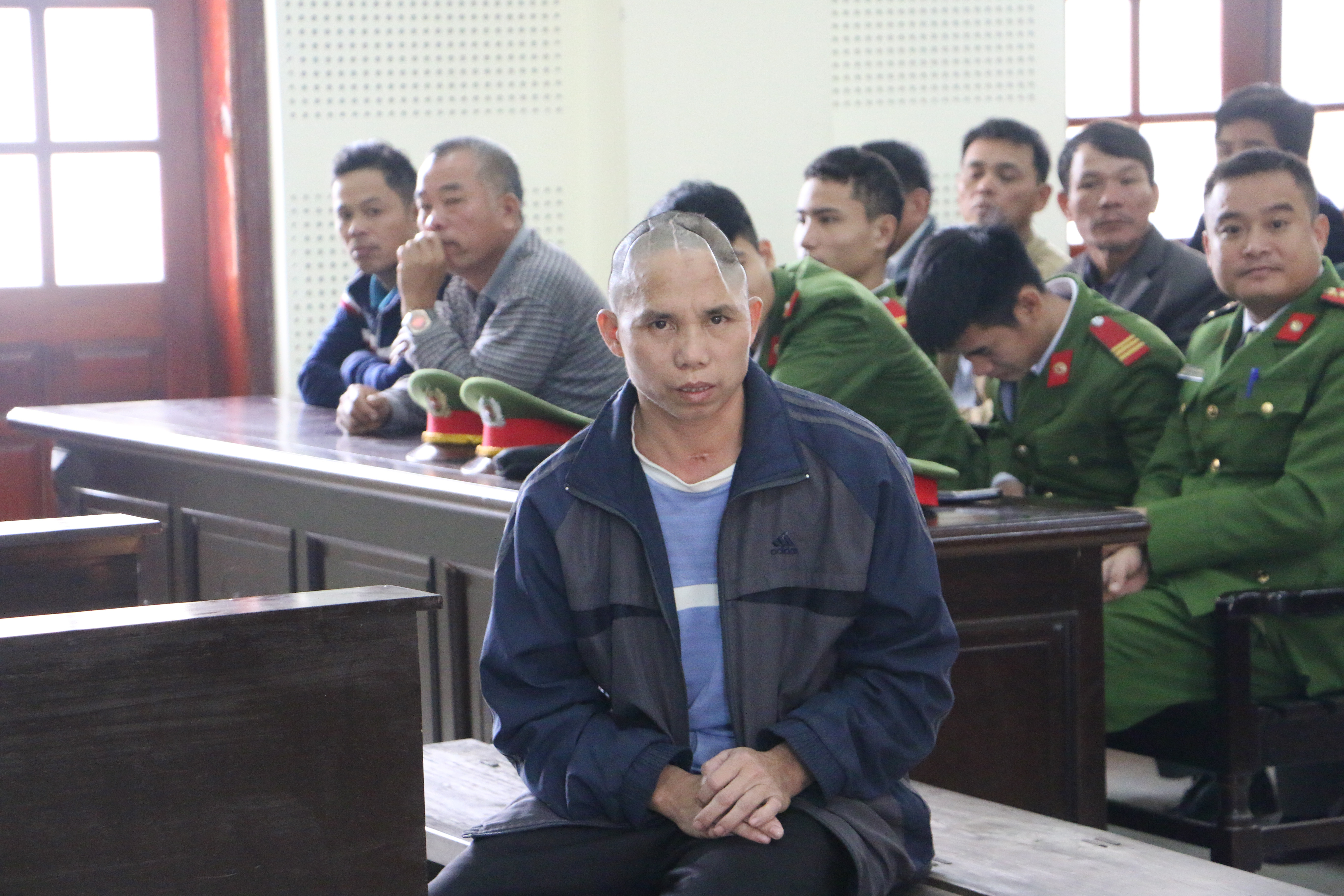 Bị cáo Nguyễn Bá Chín với đầu chặng chịt vết sẹo, lõm một mảng sọ trong phiên tòa sơ thẩm. Ảnh: Quỳnh An.