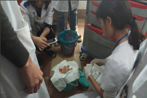 Các ngón tay của ông H bị chặt đứt rời. Ảnh: Trần Lê