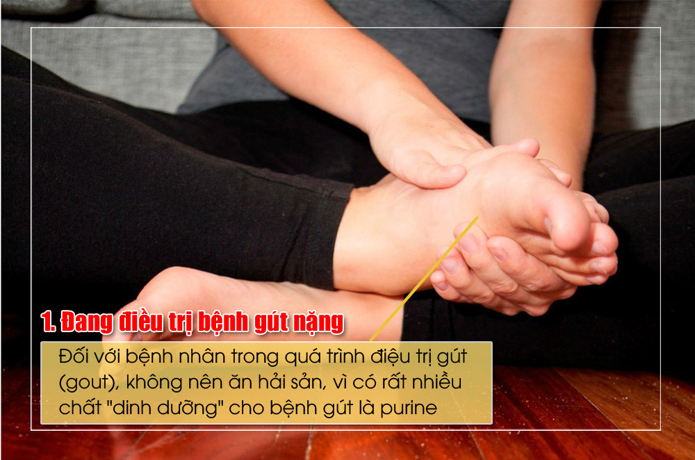 Đối với bệnh nhân trong quá trình điệu trị gút (gout), không nên ăn hải sản, vì có rất nhiều chất 