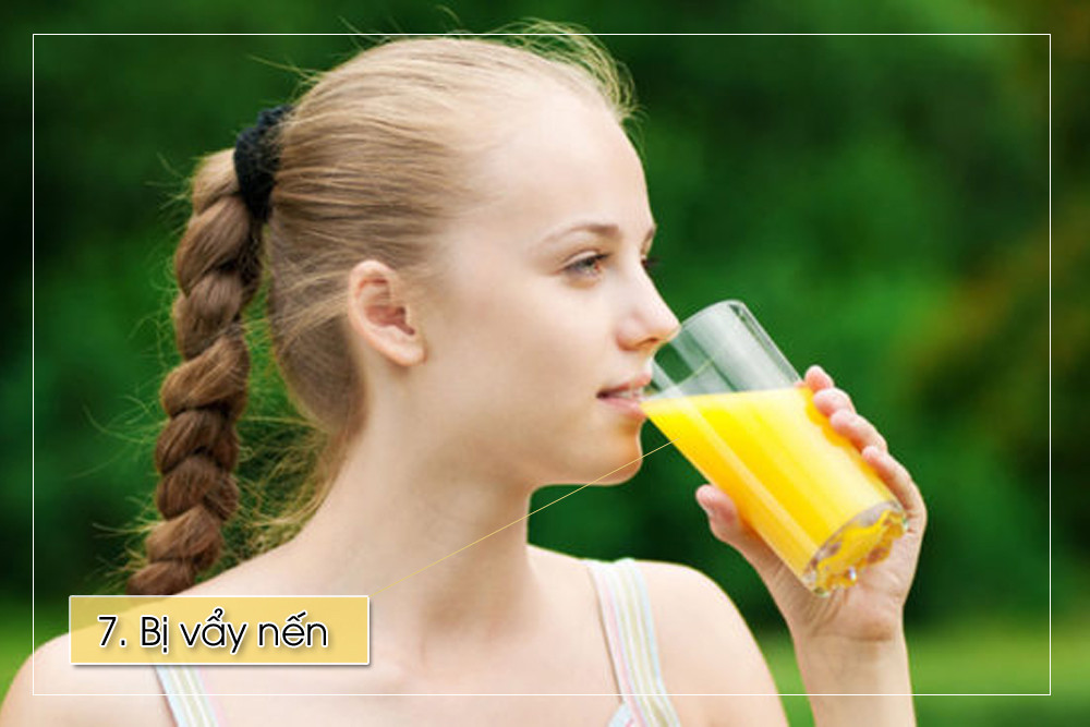 Nếu bạn bị bệnh vẩy nến, cam quýt sẽ kích hoạt các phản ứng dị ứng và làm trầm trọng thêm tình trạng bệnh.
