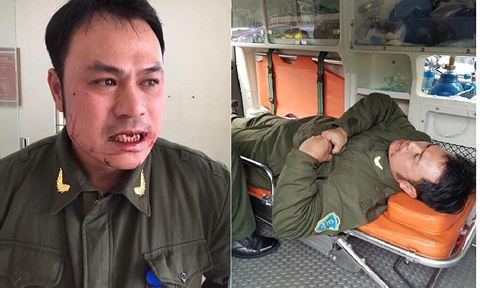 Nhân viên sân bay bị hành hung gãy 4 răng cửa.