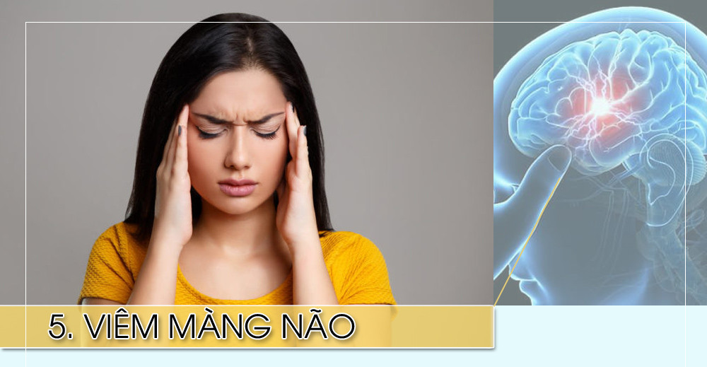 Bệnh này do vi khuẩn não mô cầu gây ra; các vi khuẩn này có thể lưu thông trong máu gây suy nội tạng rất nhanh và tử vong. Bệnh nhân rất mệt và có thể tử vong trong vòng 8 tiếng. Đây là bệnh nhiễm trùng đáng sợ nhất. Tốt nhất là nên tiêm phòng.