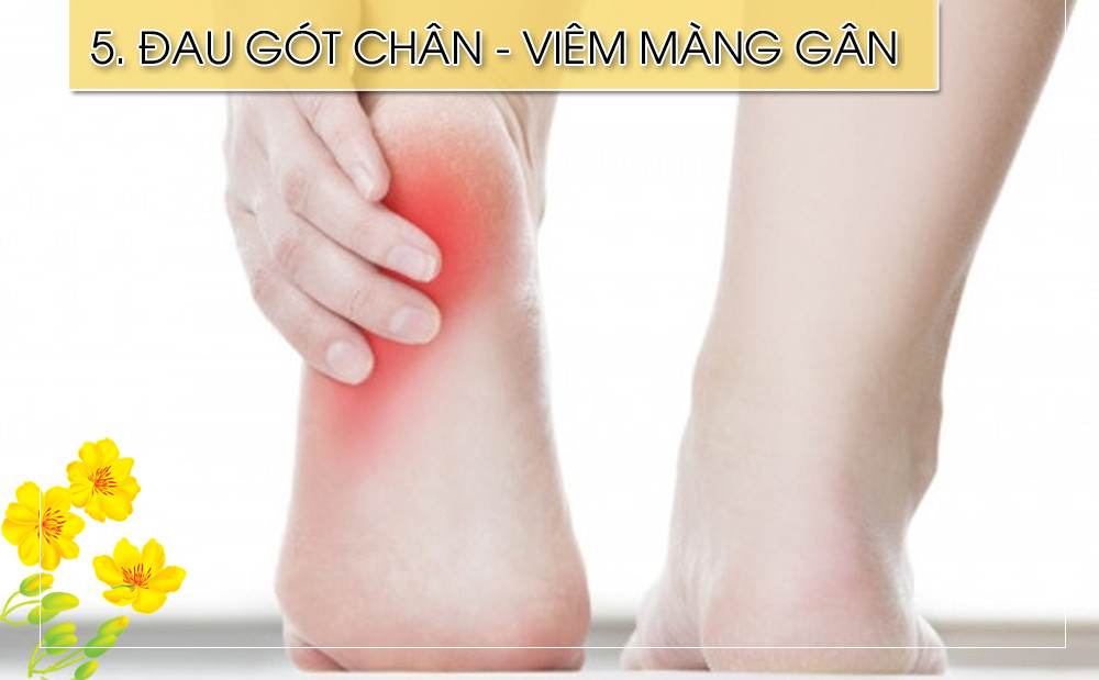 Nguyên nhân phổ biến của đau gót chân là do viêm màng gân lòng bàn chân. Cơn đau rõ nhất khi bạn lần đầu tiên thức dậy và gây áp lực lên chân. Viêm khớp do vận động quá sức, và không vừa giày có thể gây đau gót chân. Nguyên nhân ít gặp hơn bao gồm nhiễm trùng xương, khối u, hoặc gãy xương.