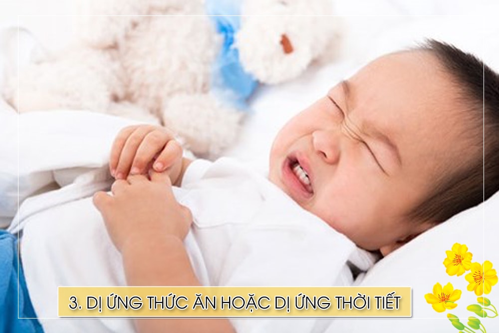 Với những trẻ có cơ địa dị ứng, việc đi lại nhiều, chế độ dinh dưỡng mất cân bằng, giờ giấc sinh hoạt bị xáo trộn,… cũng khiến cho hệ miễn dịch của trẻ bị yếu đi, làm tăng nguy cơ trẻ bị dị ứng thời tiết. Những đồ ăn thức uống lạ trong ngày tết có thể khiến trẻ bị dị ứng thức ăn.