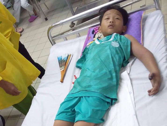 Bé Huy vẫn đang được điều trị ở bệnh viện Bạch Mai ( Hà Nội). Ảnh do người nhà cung cấp.