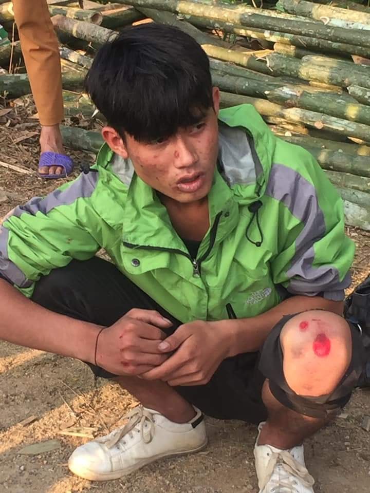 Một trong hai đối tượng cướp giật bị bắt giữ. Ảnh: Bảo Hân