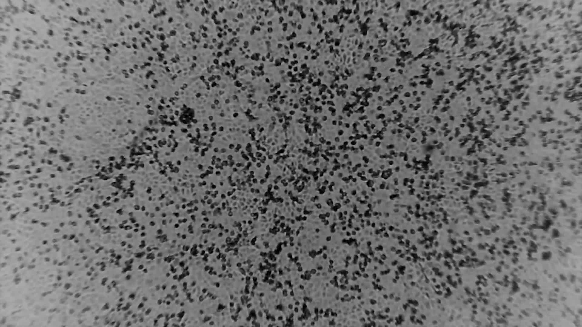 Chủng mới virus Corona dưới kính hiển vi. Ảnh: Viện Doherty, Đại học Melbourne