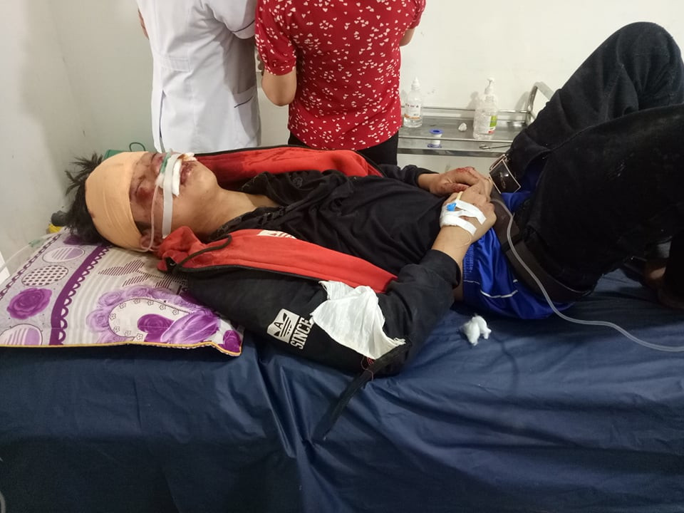 Một học sinh bất tỉnh sau vụ va chạm. Ảnh: Nguyễn Trần