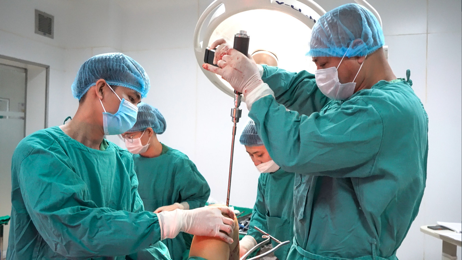 ekip các bác sĩ Khoa Ngoại Bệnh viện Đa khoa Cửa Đông thực hiện phẫu thuật đóng đinh nội tủy cho bệnh nhân H. Ảnh: PV