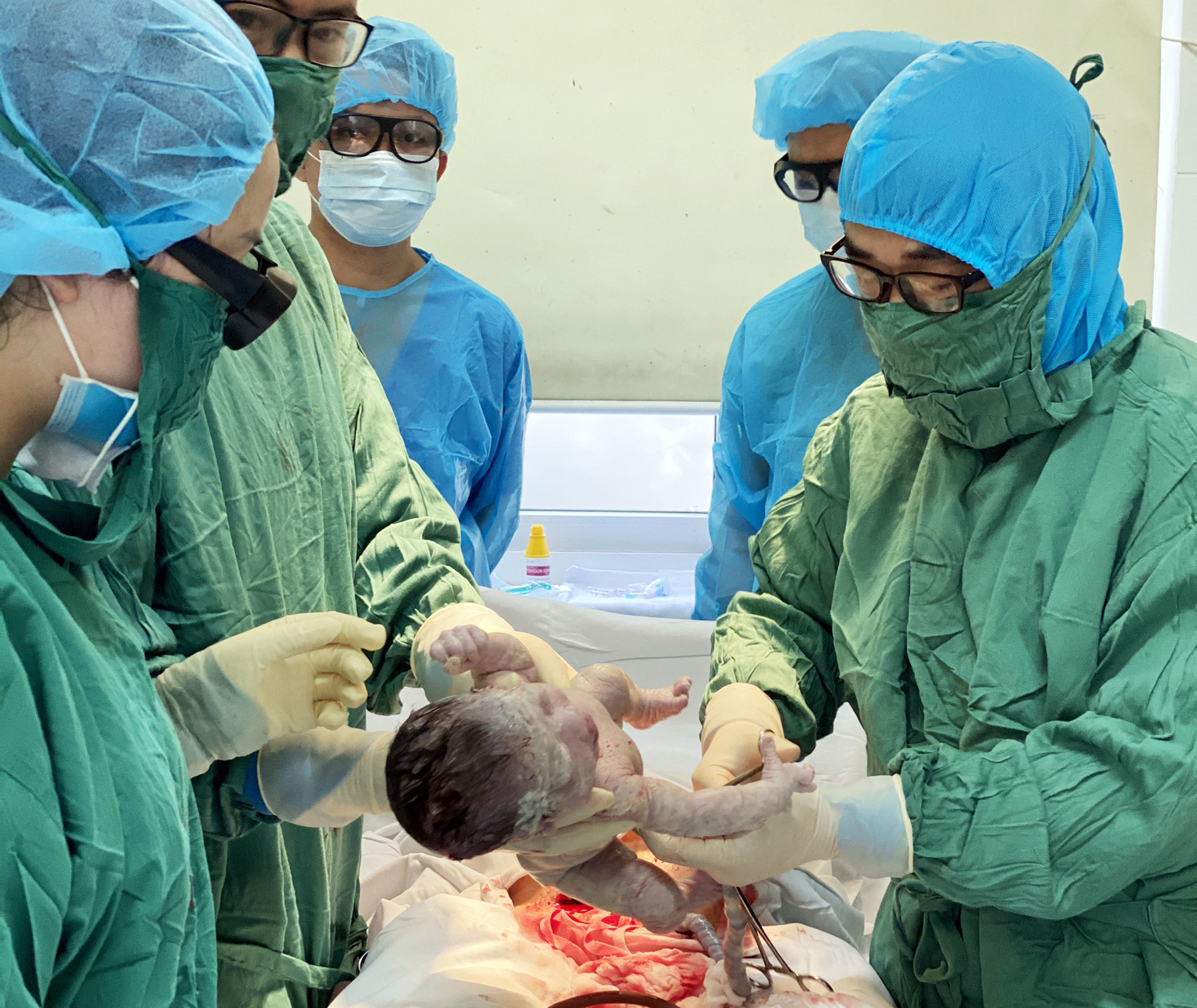 é gái chào đời nặng 3.000 g. Ảnh Thanh Sơn