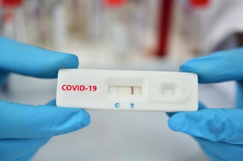 Từ ngày 21/2, mức thanh toán của test nhanh Covid-19 sẽ không quá 78.000 đồng/xét nghiệm