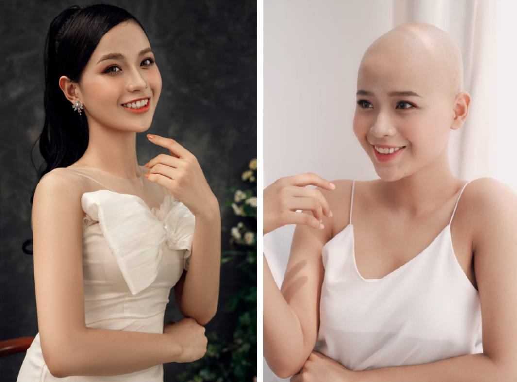 Thí sinh Đặng Trần Thủy Tiên tham gia Miss World Vietnam 2022 khi đang chiến đấu với căn bệnh ung thư quái ác. (Ảnh: BTC)