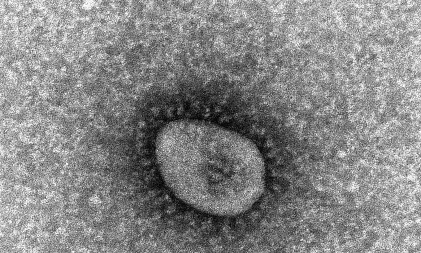 Hình ảnh dưới kính hiển vi của biến chủng Omicron. Ảnh: Kyodo