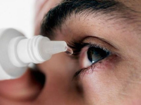F0 cần vệ sinh mắt bằng nước muối sinh lý 0.9%. Ảnh minh họa