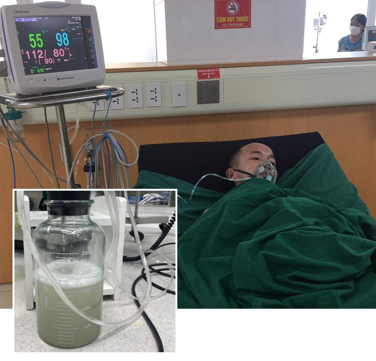 Kể từ khi phát bệnh, hầu như tháng nào anh Tàu cũng phải nhập viện; Nước rửa phổi của anh Tàu có màu sẫm (Ảnh nhỏ).