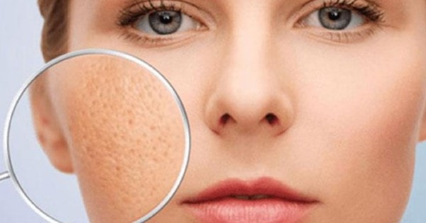 Lợi ích của sữa chua trong làm đẹp