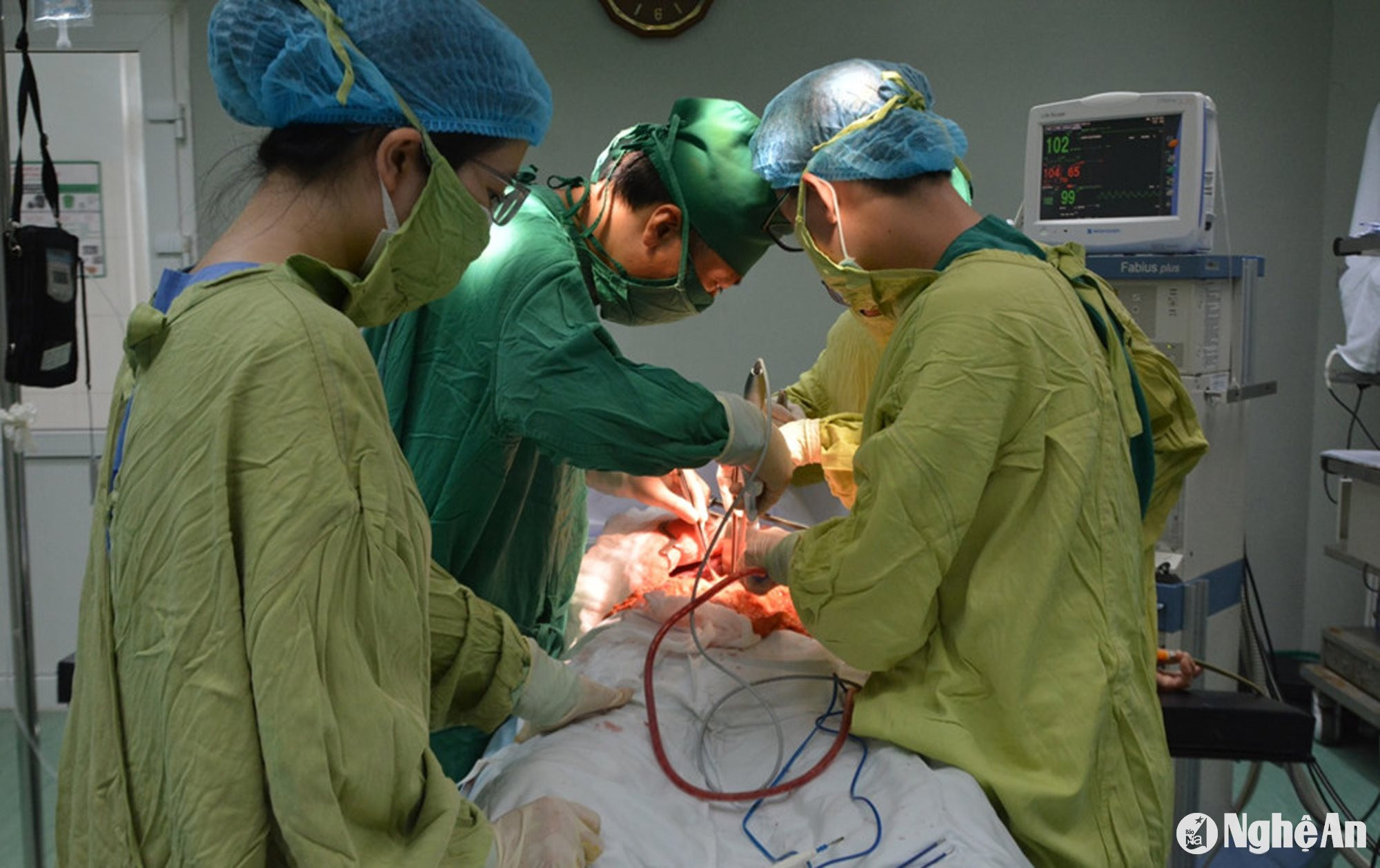 Tiến sĩ Đinh Văn Chiến - trưởng kíp mổ dạ dày đã tiến hành cắt toàn bộ dạ dày nạo vét hạch D2 cho bệnh nhân T.Đ.T. Ảnh BVHNĐKNA