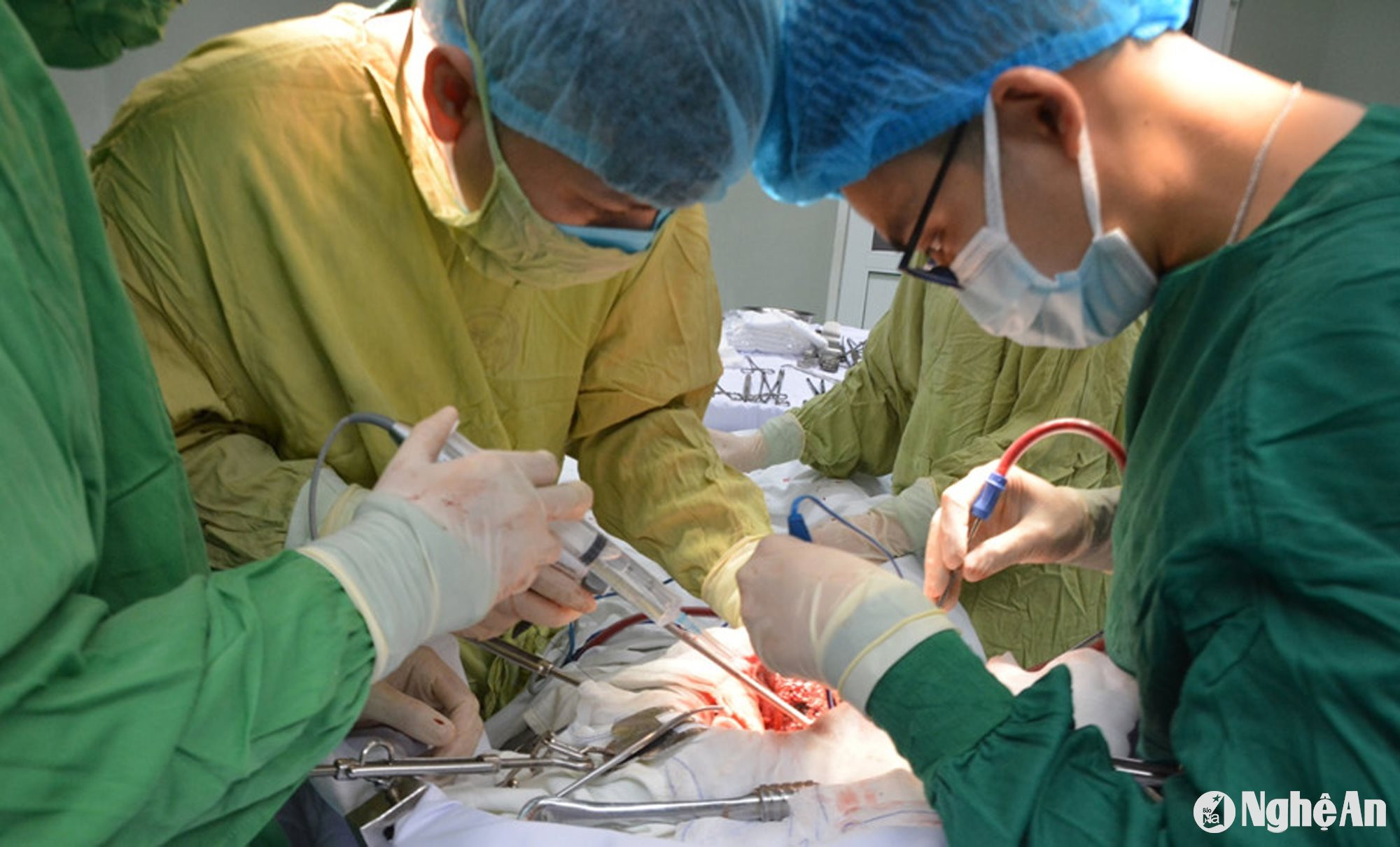 Tiến sĩ Nguyễn Huy Toàn - trưởng kíp mổ cắt gan đã tiến hành cắt gan hạ phân thùy VI. Ảnh BVHNĐKNA