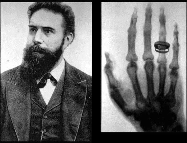 This is how German physicist Wilhelm Roentgen accidentally discovered the X- ray - India Today