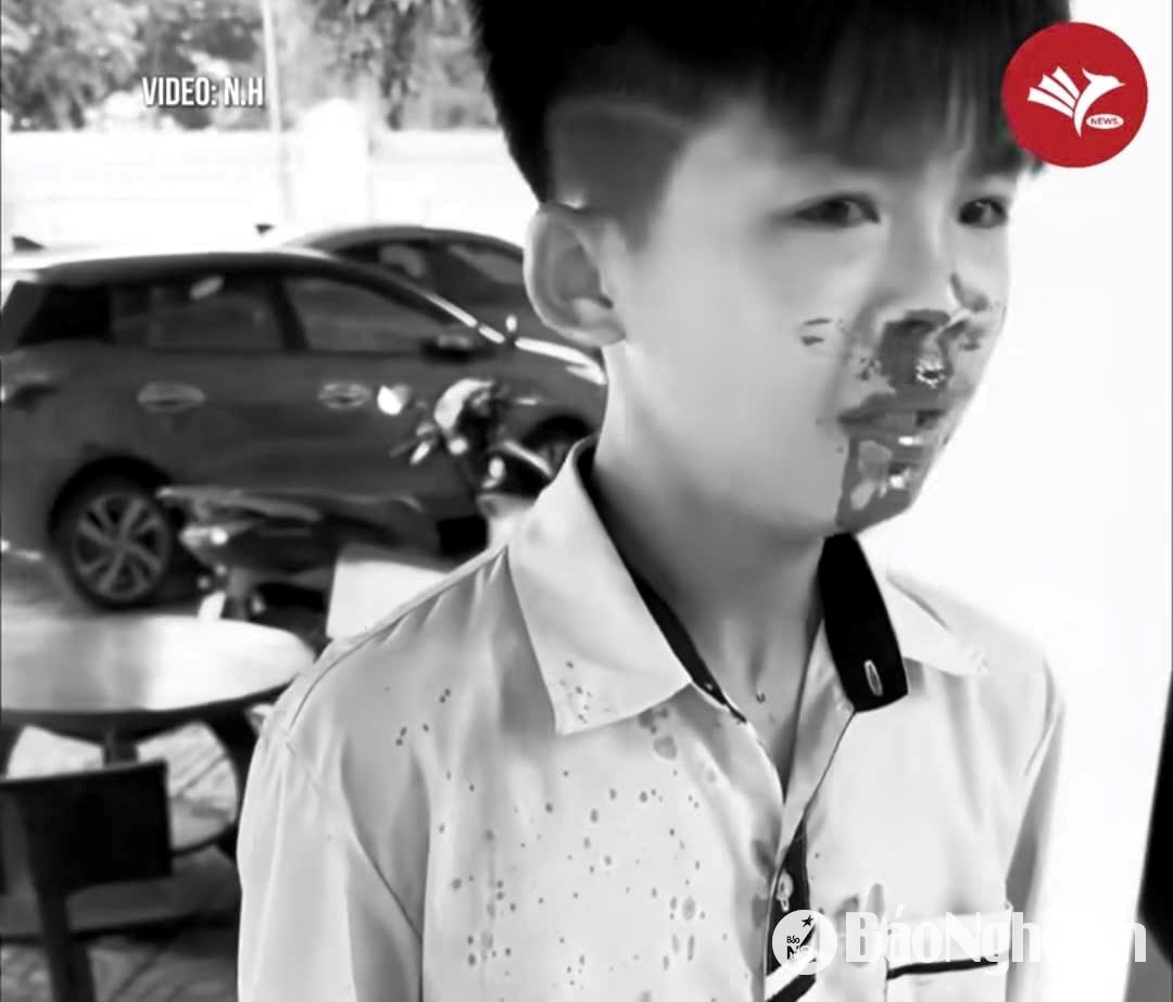3.ảnh pv