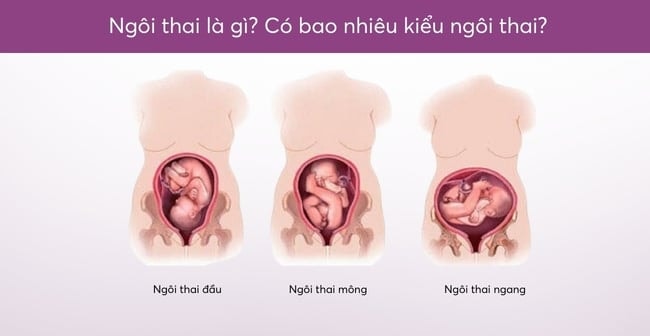 ngoi-thai-dau-la-gi-1.jpg