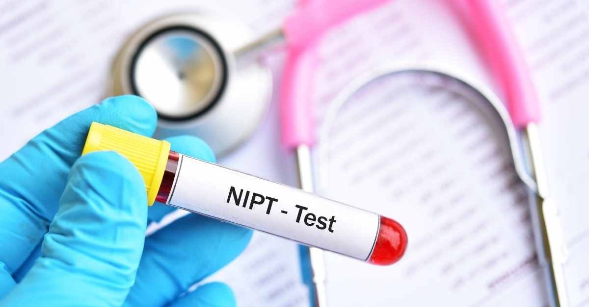Sàng lọc dị tật thai nhi (Double Test)