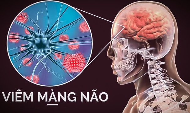 viem-mang-nao-do-lien-cau-khuan1-1691120906225345692792 copy