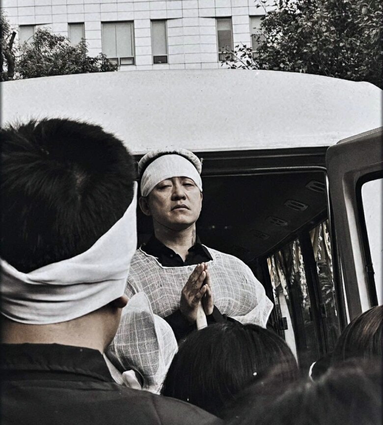 Nam ca sĩ lộ vẻ ngoài tiều tụy. Ảnh: Hải Yến Lê