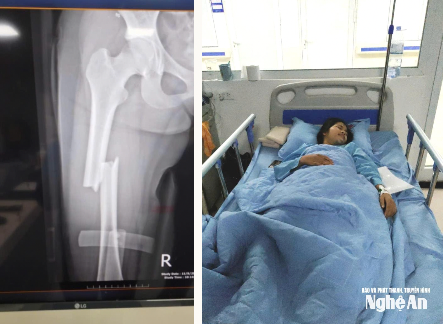 Ảnh chụp Màn hình 2025-11-20 lúc 11.12.31